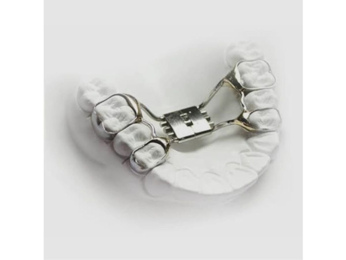 Expansor